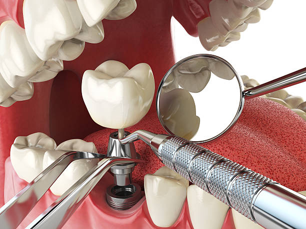 Best Same-Day Emergency Dental Services in Wake Forest, NC