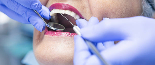 Best Emergency Dental Care for Broken or Chipped Teeth in Wake Forest, NC